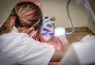 Teeth Removal Cost in Dubai